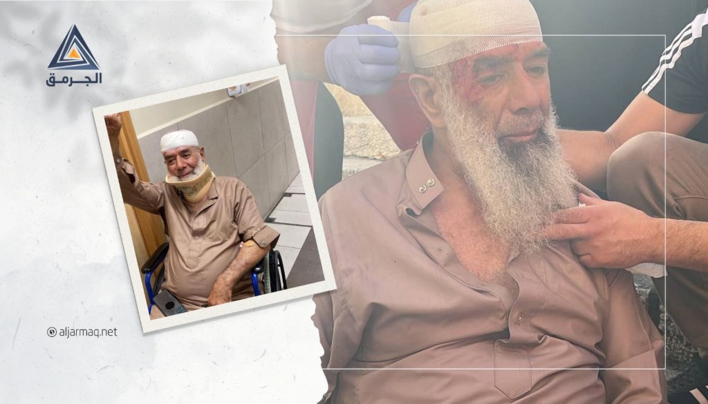 بعد التنكيل به.. المرابط خير شيمي من جديدة المكر: كل ما نملك فداء للأقصى