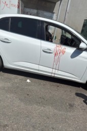 إصابة شابة بجروح خطيرة بجريمة إطلاق نار قرب رهط